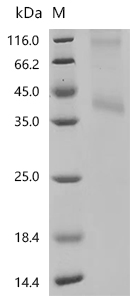 Observed band size: Monomer: 42 kDa Dimer: 110 kDa
It is speculated that the protein forms a dimeric structure.
(Tris-Glycine gel) Discontinuous SDS-PAGE (reduced) with 5% enrichment gel and 15% separation gel. Boiling SDS-treated samples may result in membrane protein aggregation. Incubation at 37 ° C for 10 min is an effective alternative.